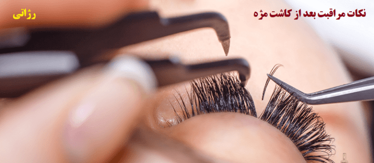 نکات مراقبت بعد از کاشت مژه-رژاتی